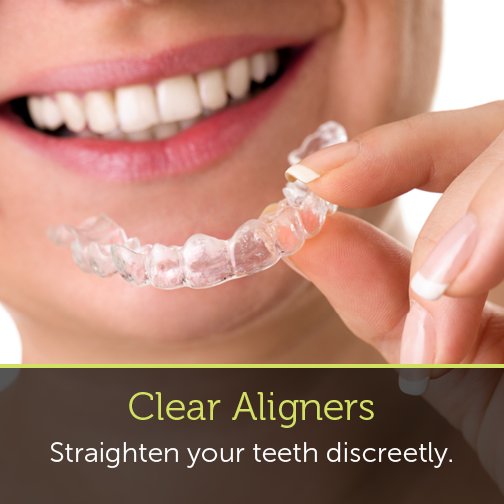 With nearly invisible teeth straightening systems, others won’t even notice you’re wearing aligners. Learn more here ow.ly/M5QJ304rnVE