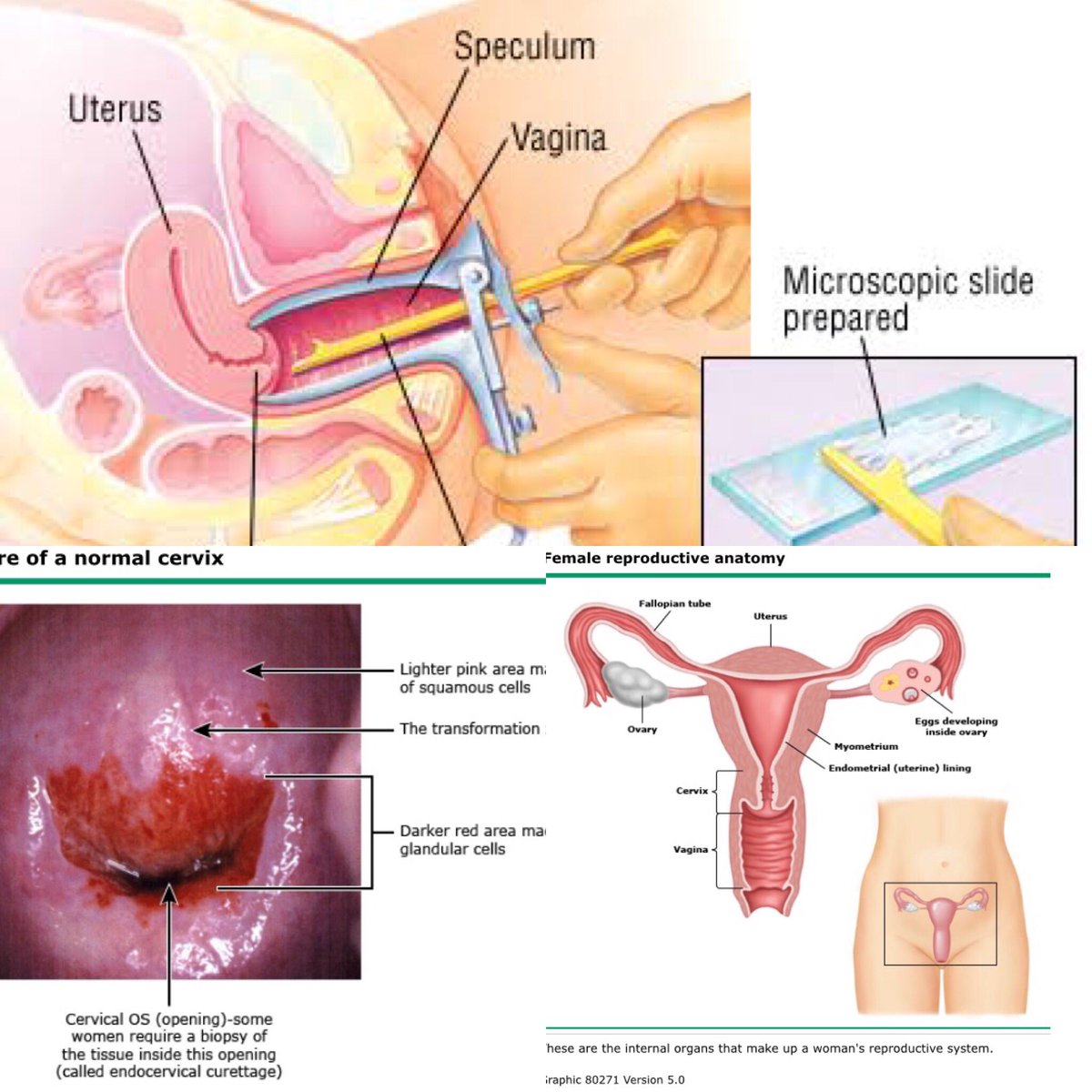 aatmadja's tweet photo. Penapisan dini cancer serviks adalah papsmear https://t.co/qNNbU4PnBk