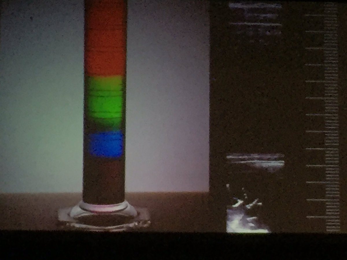 gregorprosen's tweet image. #LungUS is like #densitometry of lung tissue 
@GioVolpicelli #WCUME16