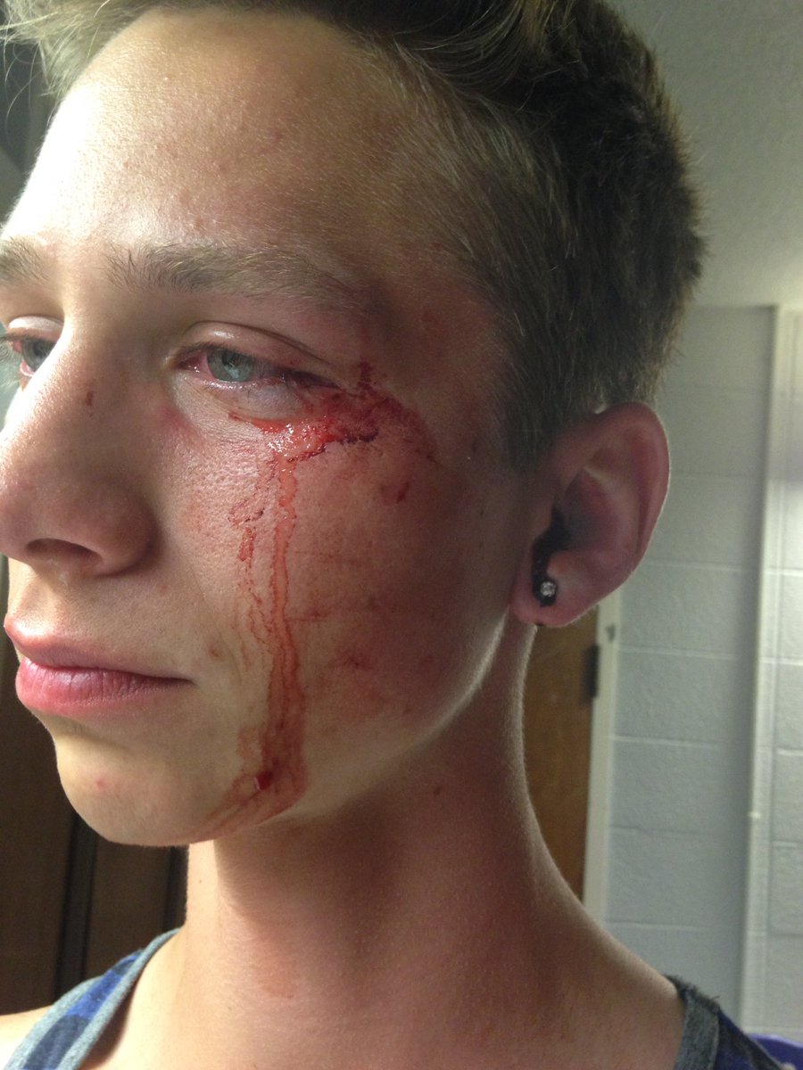 mcswag213's tweet photo. 🍊 ATTENTION ALL UT STUDENTS 🍊 Please share this story with everyone you know, we're trying to find out who did this to Jacob. Please help us https://t.co/LbN019voyA