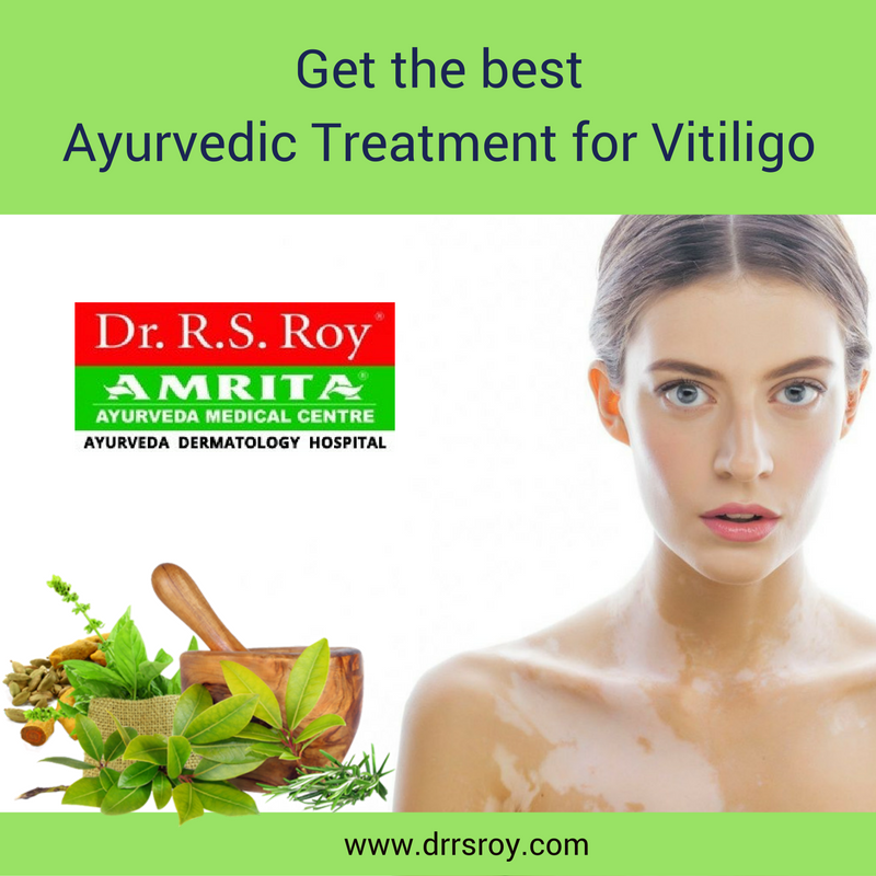 drroyrs's tweet image. #Vitiligo or #Leukoderma as it is often known is characterised by white patches all over the body and scalp. Click drrsroy.com/vitiligo/