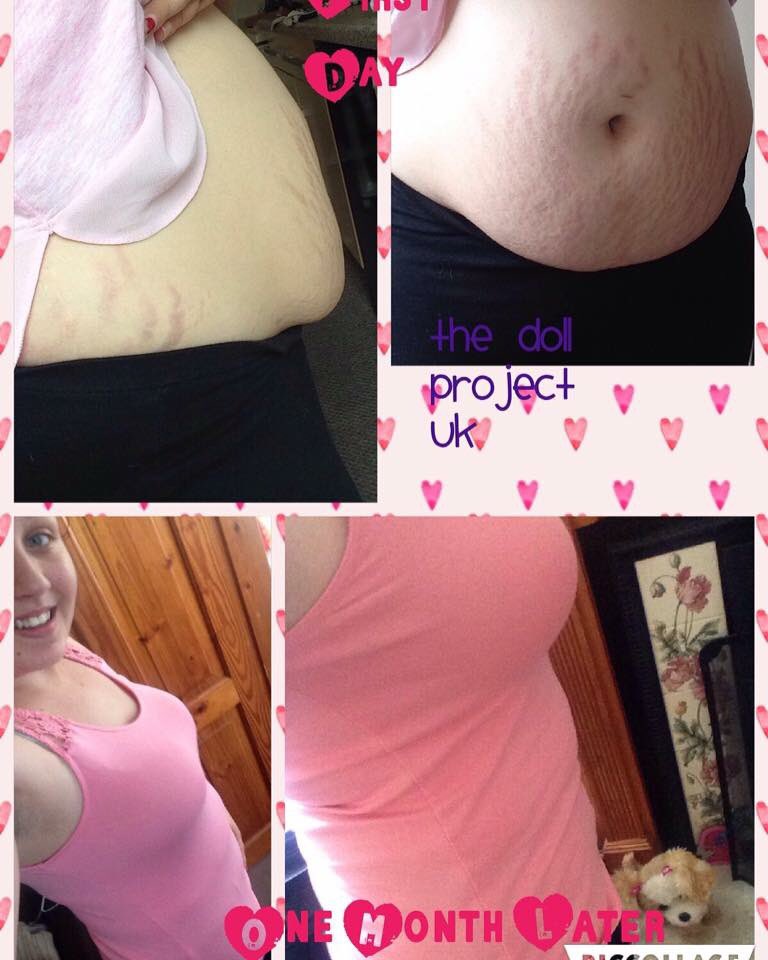 ThePicturePerf's tweet image. 1 MONTH and 3 days later 👇🏼 results 🔥.
#BOOSTER and #BERRYBLEND capsules work their magic 💛😍