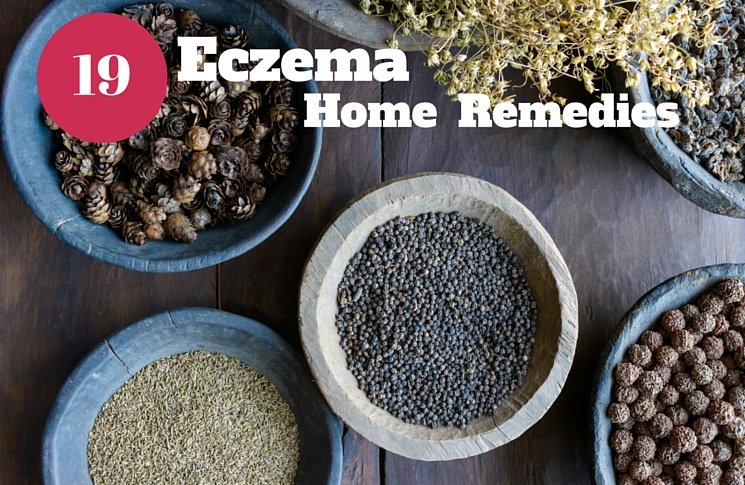 terryfoster1121's tweet photo. Which one of the next eczema remedies worked for you? https://t.co/TUT5xv2Puc @broadlumab #eczema #health #skincare https://t.co/RR7zTc3eLN