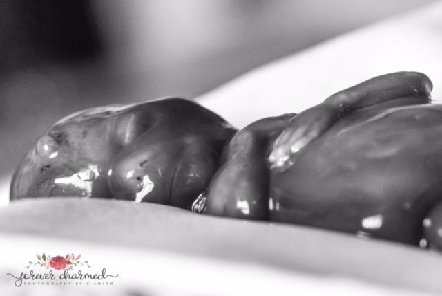 LifeNewsHQ's tweet image. Mother Releases Photos of Daughter Miscarried at 17 Weeks to Help Stop Abortions buff.ly/2dhEiDD