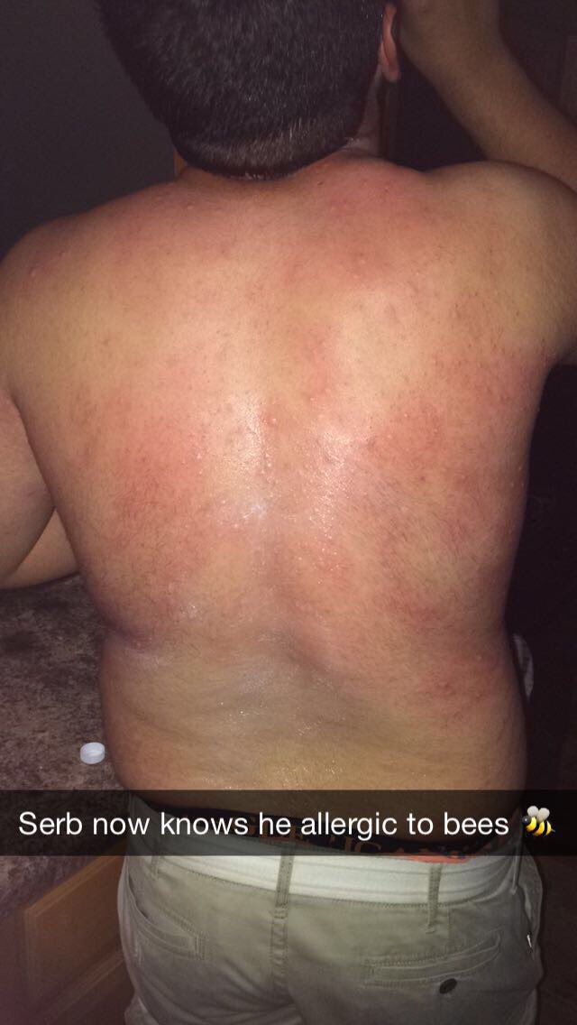 ForSerb's tweet image. Serb might be allergic to bees but he's not allergic to your vote! 🐝🙅🏻#vote4serb