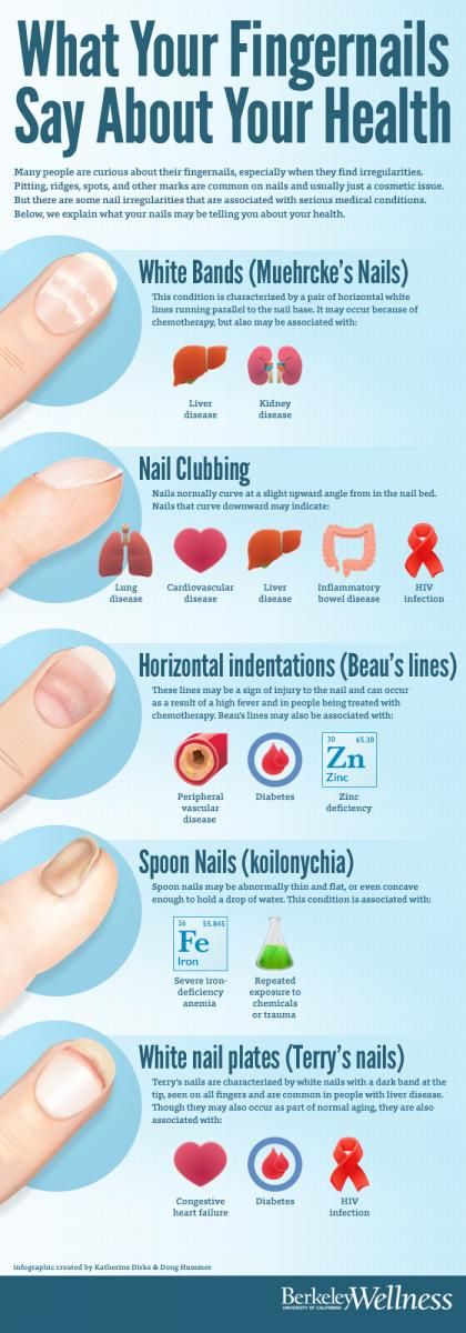 6 Signs Your Fingernails Are Trying To Tell You Something - Organic Olivia  | Fingernail health, Nail health, Body health