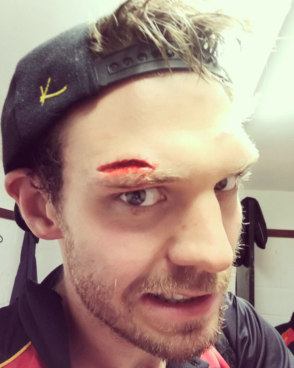 Karuta Sportswear (@karutasports) on Twitter photo Just a scratch he said 👀 <a href="/GeorgeSluman/">Adele Patterson</a> of <a href="/BridgwaterRugby/">Bridgwater & Albion</a> with a nasty cut, nothing his Karuta SnapBack can't cover up 👌 #KarutaSportswear Just a scratch he said 👀 <a href="/GeorgeSluman/">Adele Patterson</a> of <a href="/BridgwaterRugby/">Bridgwater & Albion</a> with a nasty cut, nothing his Karuta SnapBack can't cover up 👌 #KarutaSportswear