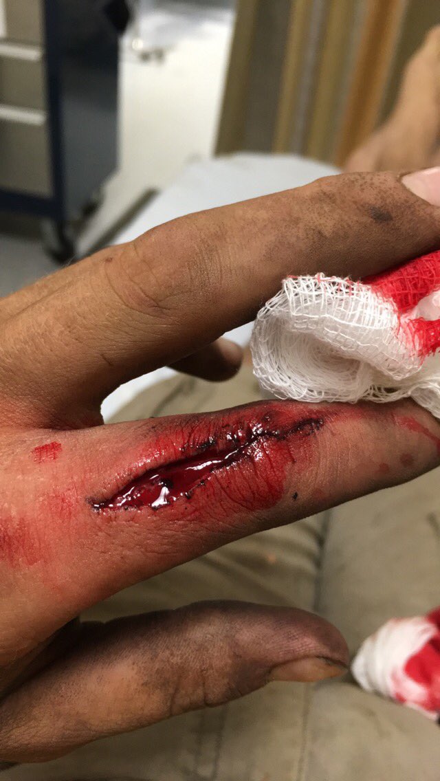 RoppRyan's tweet image. 3 weeks later #PlaySafeKids ⚙💉