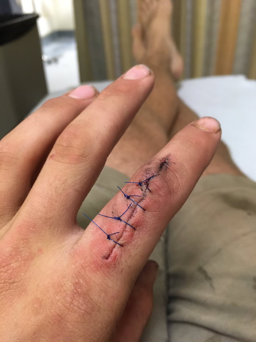 RoppRyan's tweet image. 3 weeks later #PlaySafeKids ⚙💉