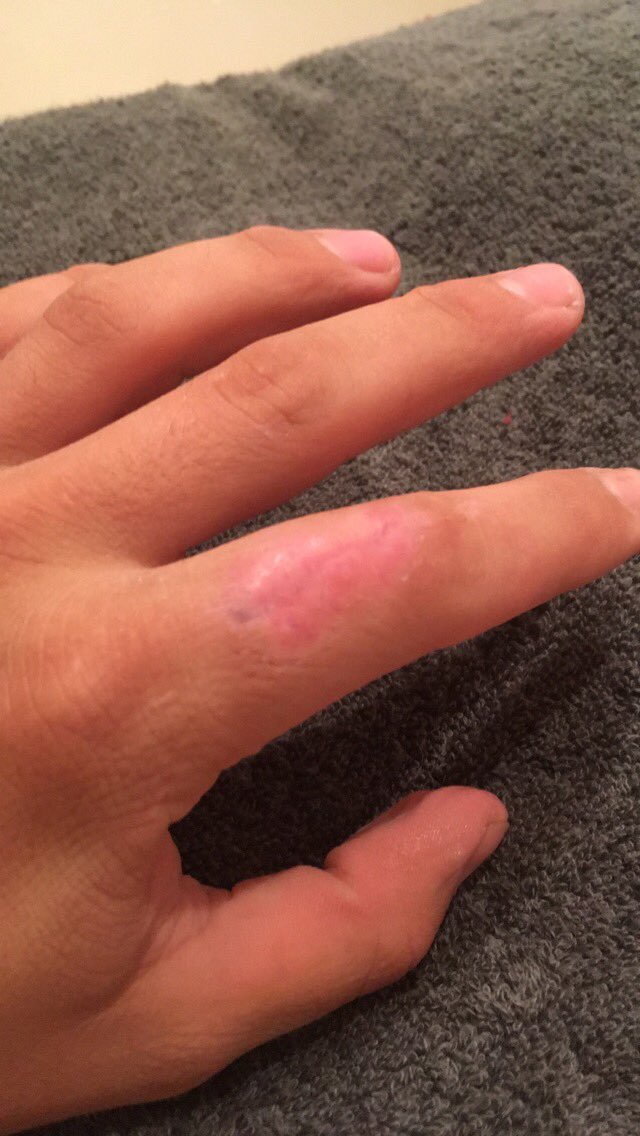 RoppRyan's tweet image. 3 weeks later #PlaySafeKids ⚙💉