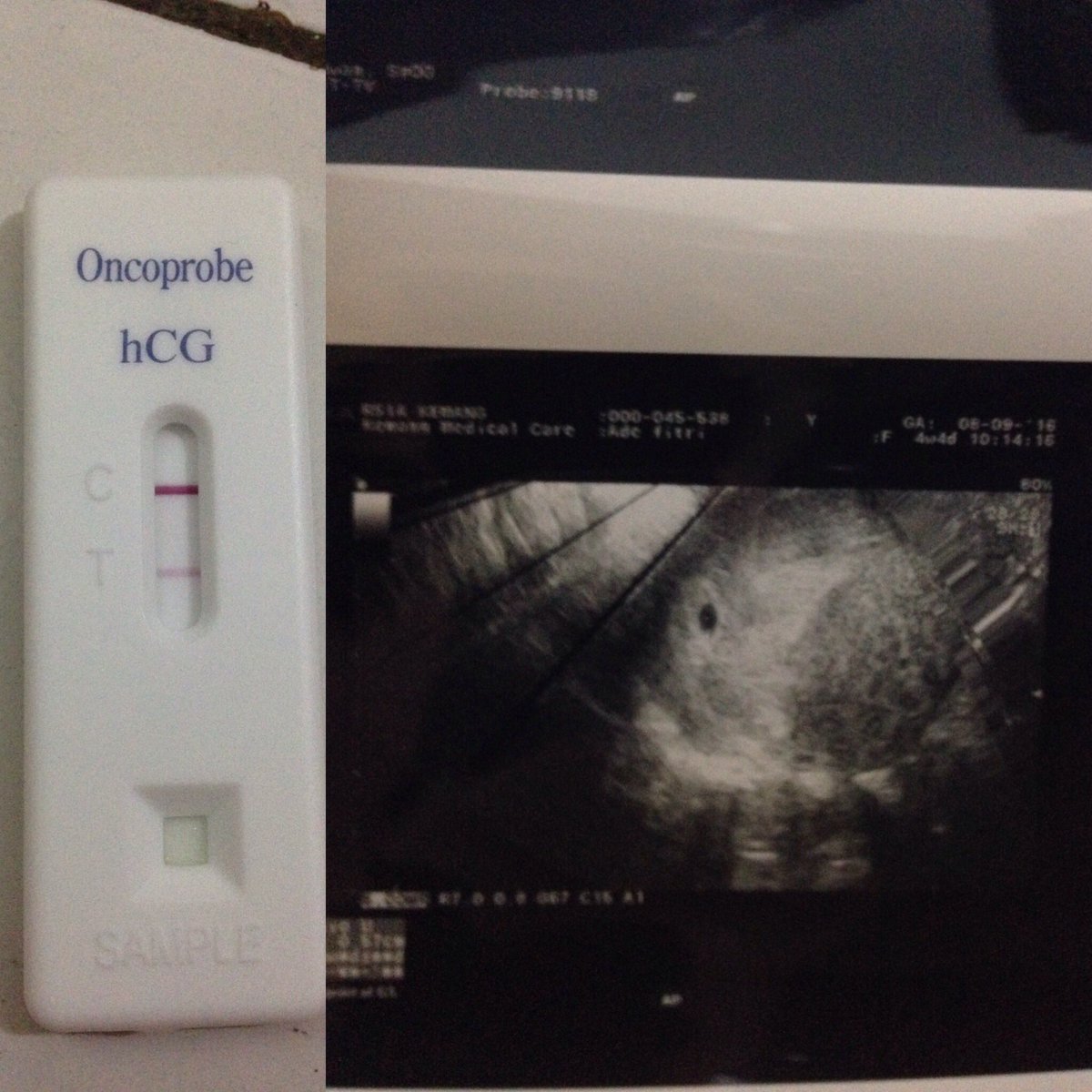 adefitrik's tweet photo. Sayang mommy udah kayak apa ya sekarang udah pinter gak ya, minggu depan baru ketemu lagi ya sayang, ketemu juga sama om dr. Ridwan, SpOG https://t.co/uy0oStp2P2