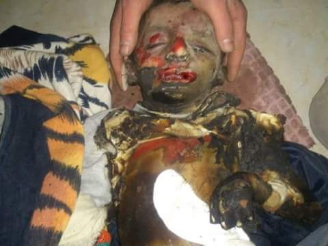 evassdadt's tweet photo. #AleppoUnderAttack  PLEASE HELP ALEPPO .. BABIES ARE DYING 

 #멘션_온_음식_호불호 https://t.co/QYxZ4NkLG6