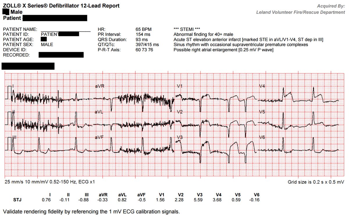 ecgwatford's tweet image. 20 minutes apart. Didn&apos;t notice the change in statements. Glad we don&apos;t call them based on that! #CodeSTEMI #EMS #FOAMed #FOAMems