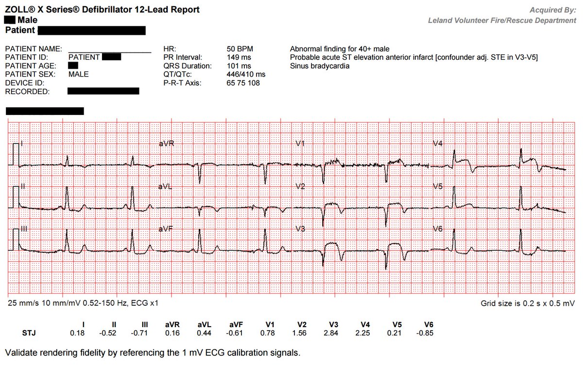 ecgwatford's tweet image. 20 minutes apart. Didn&apos;t notice the change in statements. Glad we don&apos;t call them based on that! #CodeSTEMI #EMS #FOAMed #FOAMems