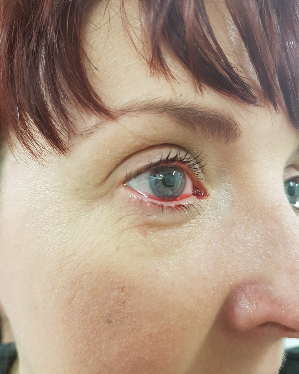 EmilyBaileyx's tweet photo. Kelly demonstrated how to get a blood shot eye effect using blood eye drops #rothcoll @inspiremakeup1 https://t.co/uj0aQXeFQj