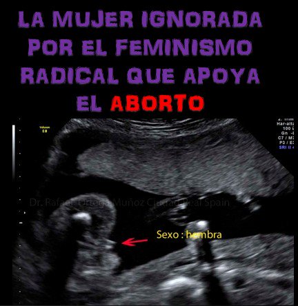 bj_super's tweet photo. ¿Qué de seguro tiene un procedimiento donde al menos uno de los que intervienen , es asesinado? https://t.co/Bp3B7WQJWb