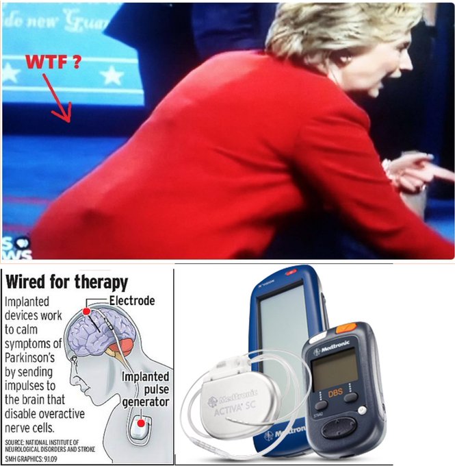 PHOTOS: WHAT’S THAT UNDER HILLARY’S PANTSUIT.... CtWY8t1W8AAEQNi