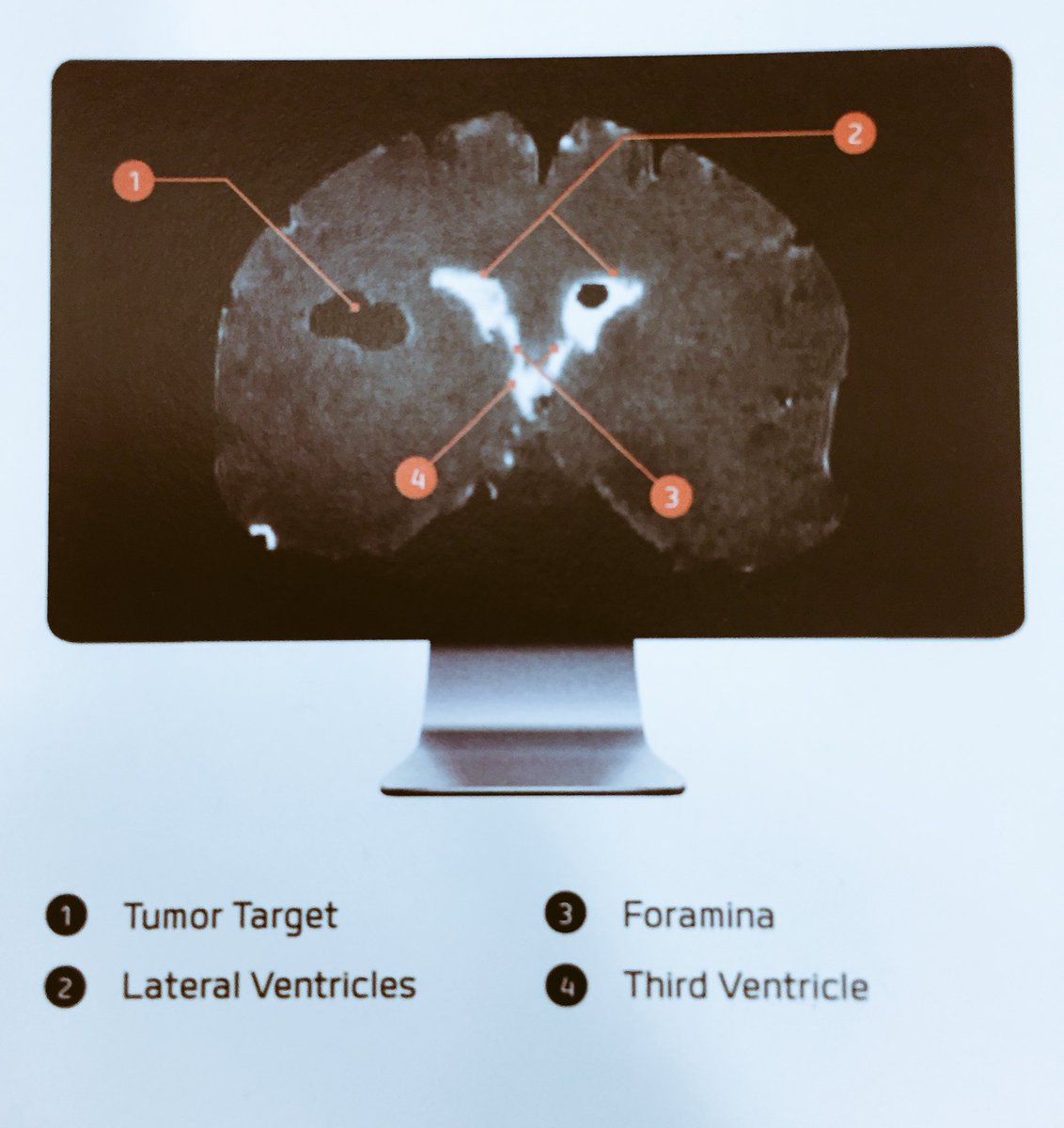 BrainSimulator's tweet photo. A Simulator with lateral & third ventricles and interconnecting foramina of Monroe for immersive training @SynaptiveMed
#Haveyouseenityet https://t.co/CkTqvtQbad