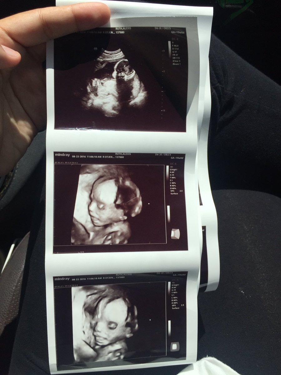 sunfIowered's tweet photo. Hey guys, another lil update for ya: in three months I'm going to be having a little girl💗 I'm beyond blessed. I love y'all. https://t.co/qnSHMaVJr3