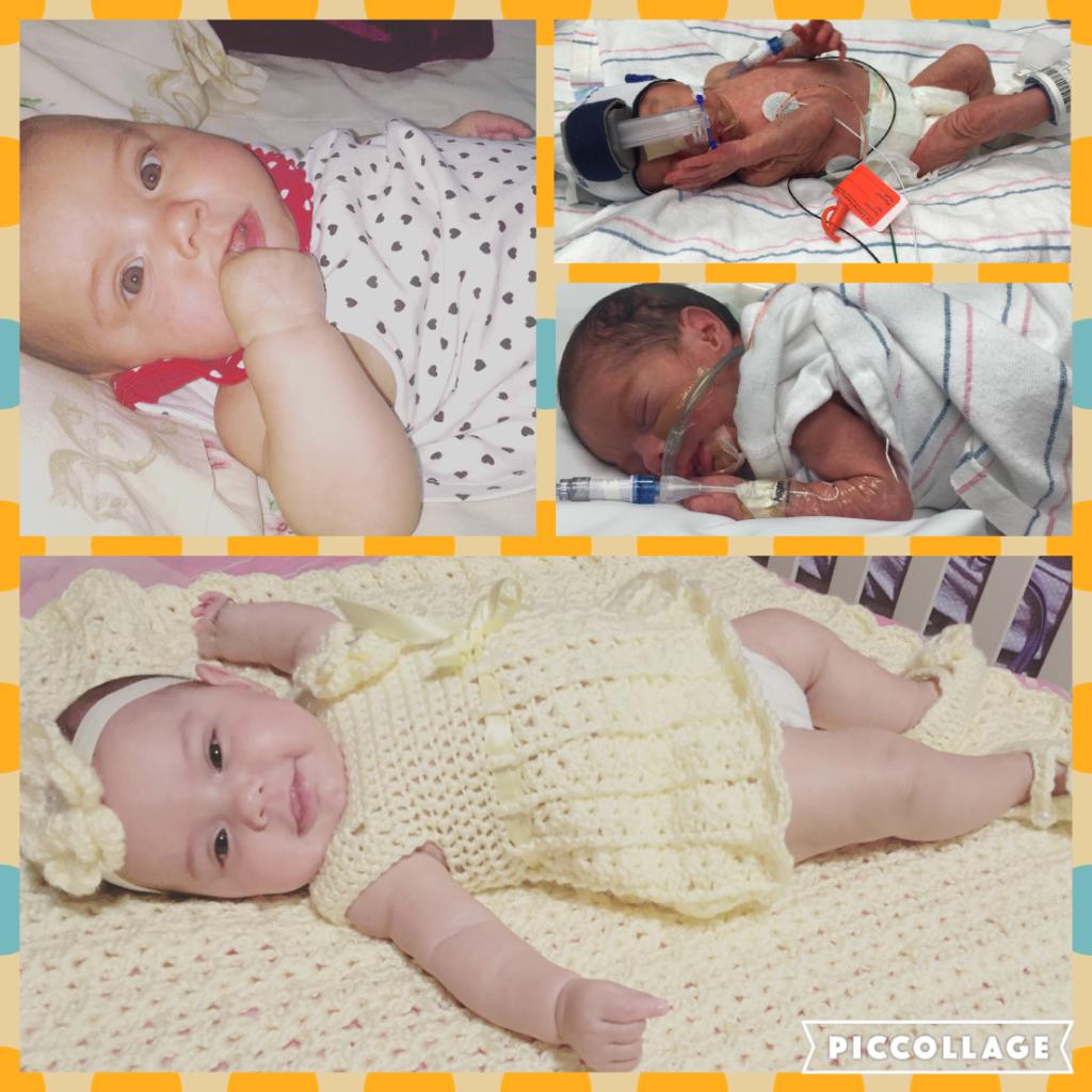 For #NICUtoNow here's Michelle, born at 31 wks. She fought thru 2 mos in the #NICU &amp; now she's almost 1! #NICUgrad