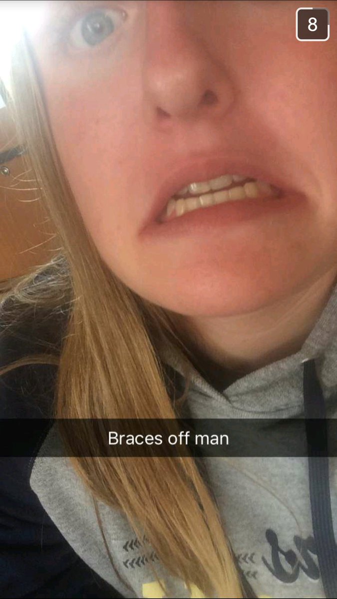 Kylie_Hoth's tweet image. @FuzzHoth looking good with the straight-ish teeth 😂😆😆 #5yearslata #startedfrombottom