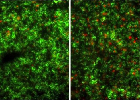 DrBrennanMD's tweet photo. RT @pc_of_az: Researchers develop new strategy to limit side effects of #stemcel… https://t.co/G6i9HnETul https://t.co/NcBpTrXFkv