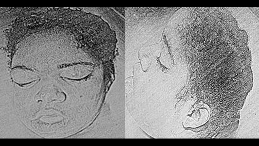 Cops release sketches of person whose head was found in McKinley Park Lagoon