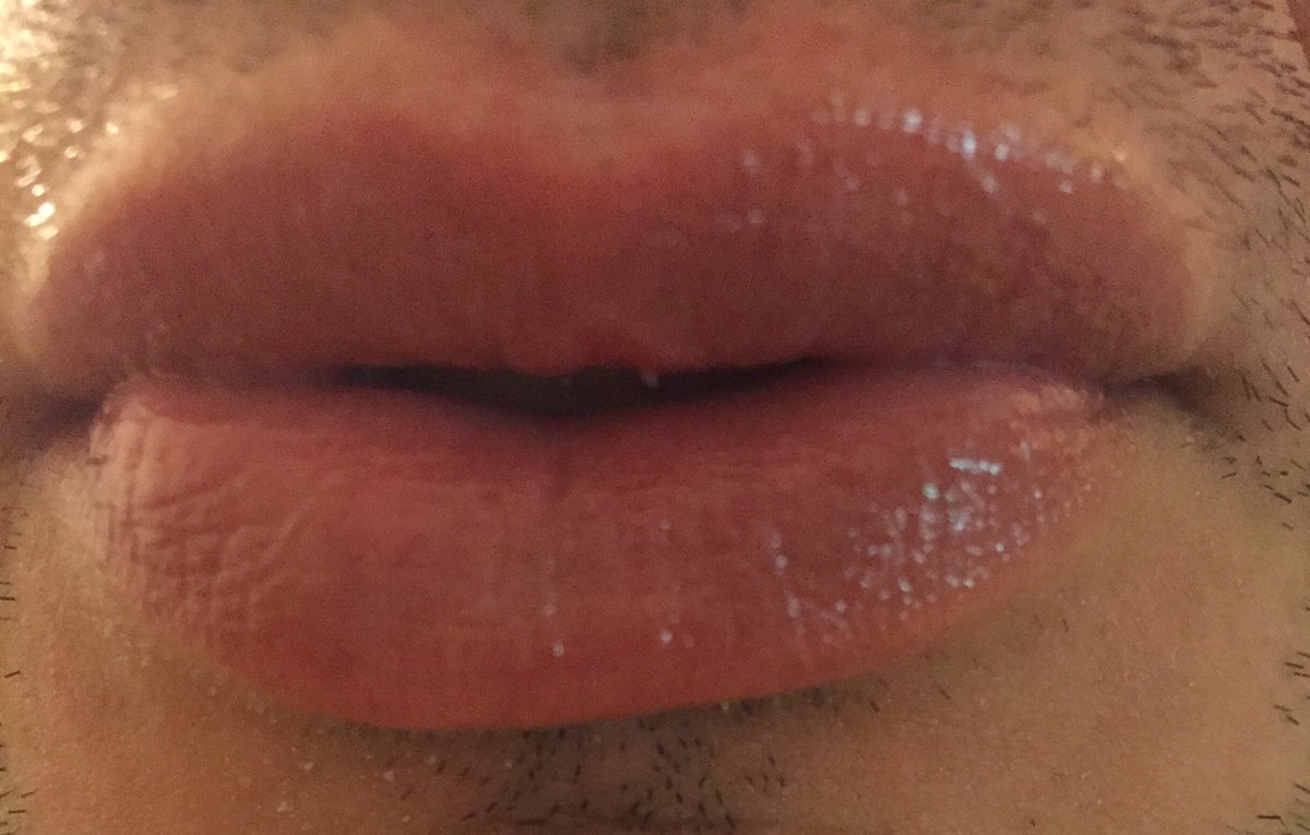 joenoventa's tweet photo. #Encuesta están #operados estos #labios ? Yes or nop @aniballotocki https://t.co/akf3ZKXMv4