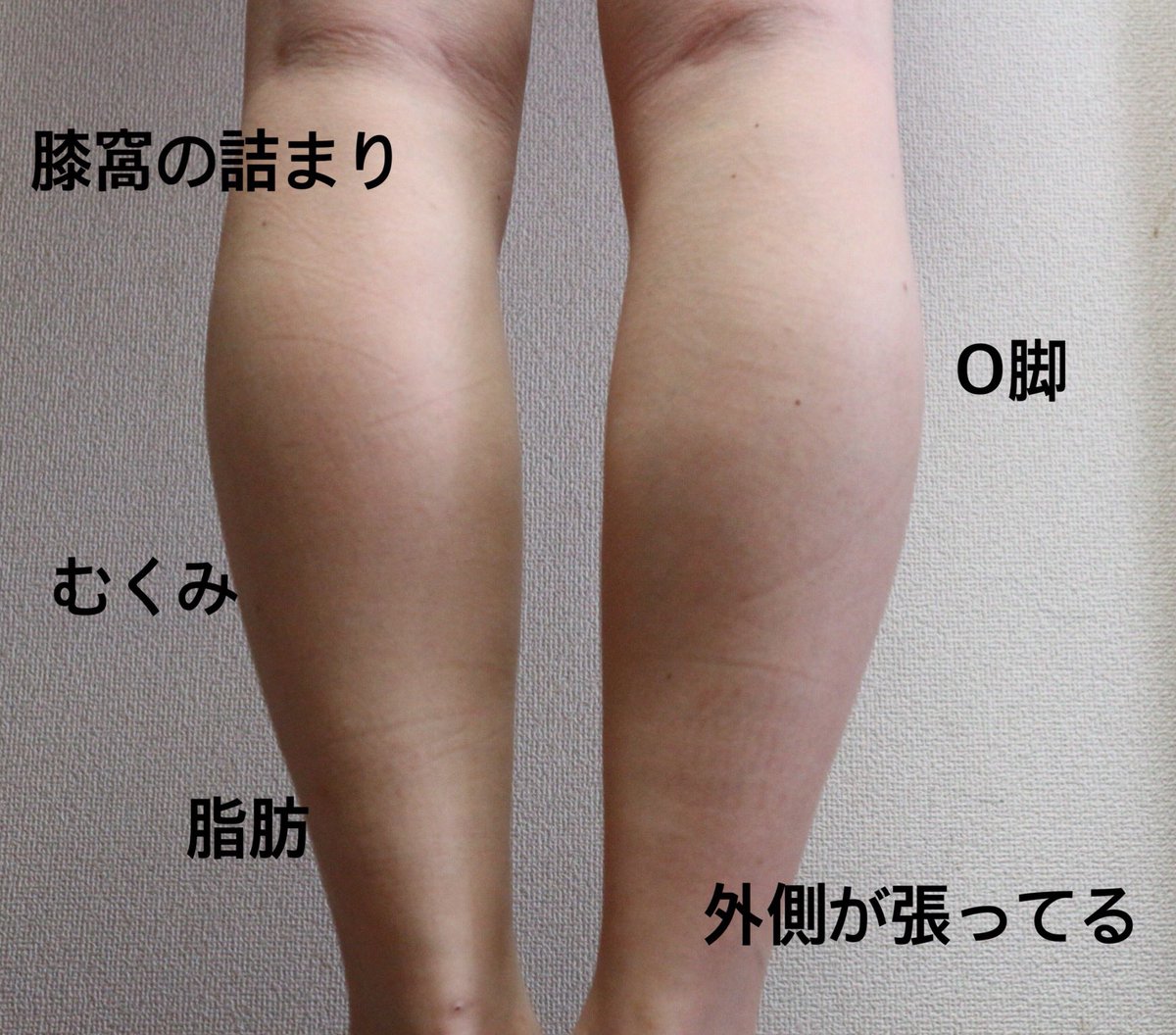 生理前 お腹が空く悪魔に取り憑かれてる気分 はぁ 生理前と上手く付き合う方法あみださないとーーー 今日からお風呂上がりリファのマッサージはじめます 変化わかるように撮ってみた 生理前 お腹が空く悪魔に取り憑かれてる気分 はぁ 生理前と上手く付き合う方法あみださないとーーー 今日からお風呂上がりリファのマッサージはじめます 変化わかるように撮ってみた