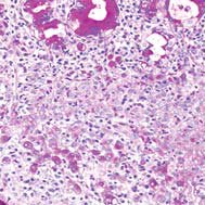 novogencomtr's tweet photo. PAS Kit (Periodic Acid-Schiff)
https://t.co/9mLBVvyKcp
#paskit #pasboyası #periodicacidschiff #stainkit #biognosttürkiye #histolojiboya #pas https://t.co/IgfaW0TOCM