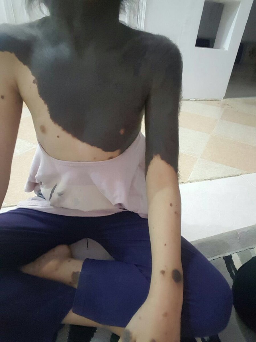 اتمنى ان تمنشنون ذوي الاختصاص ،،

ابنة صديقي العزيز عمرها ٩ سنوات تعاني من مرض لايعلمه إلا الله