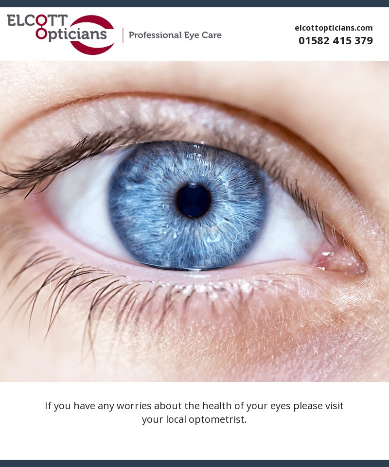 ElcottOpticians's tweet image. #opticians #eyecare #Luton