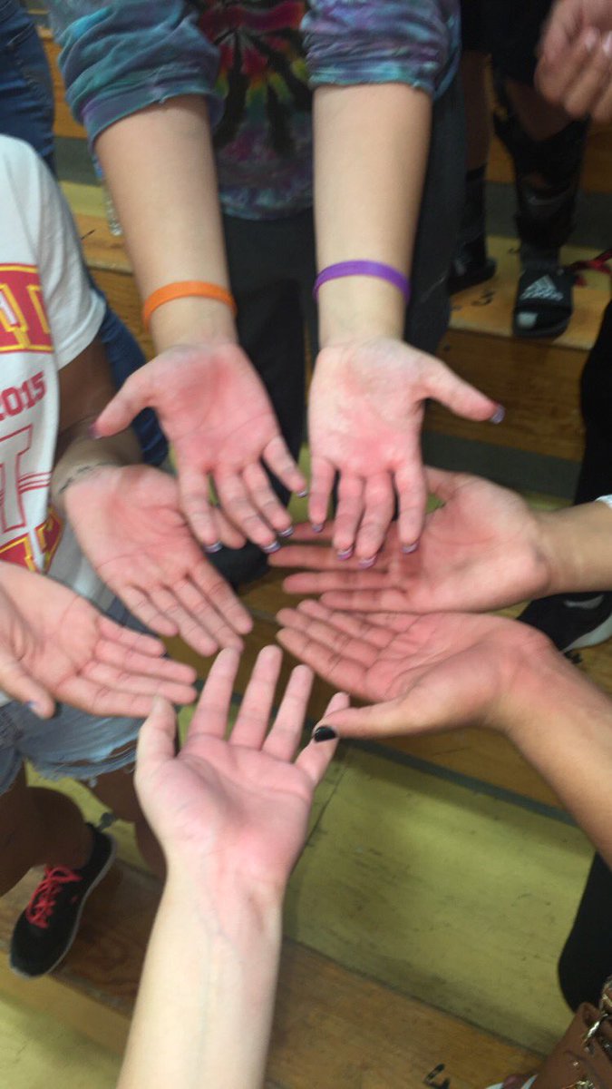 morganearleyy's tweet photo. When the swarm gets the best of you #ouch #jacketmania https://t.co/RMJ3VKm5An