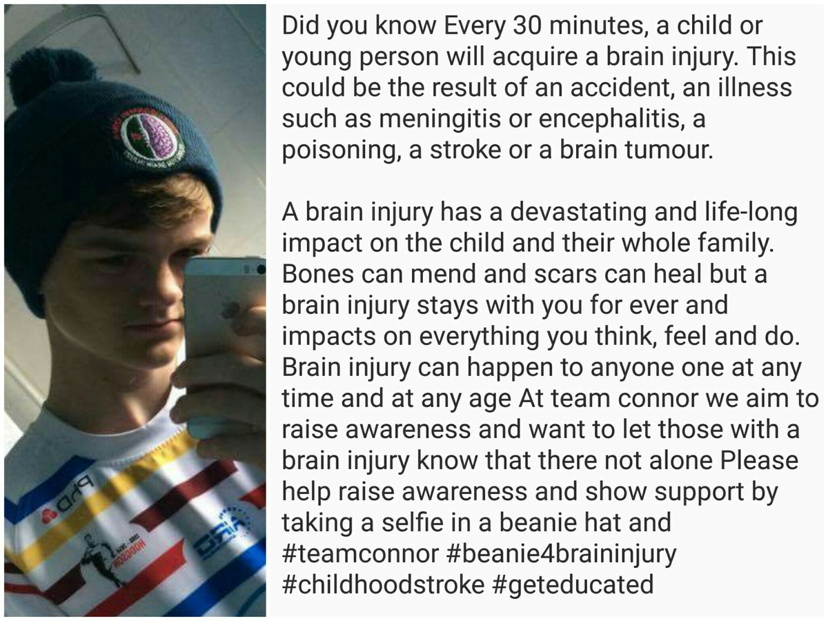 Tomorrow is beanie 4 brain injury can u help raise awareness plz rt @RugbyLeague2016 <a href="/smohull/">SMO</a> <a href="/ScottTagTaylor/">Scott Taylor</a> <a href="/terrycampese6/">Terry Campese</a> <a href="/JohnBoudebza/">CELESTIA || TIA CRYPTO</a>