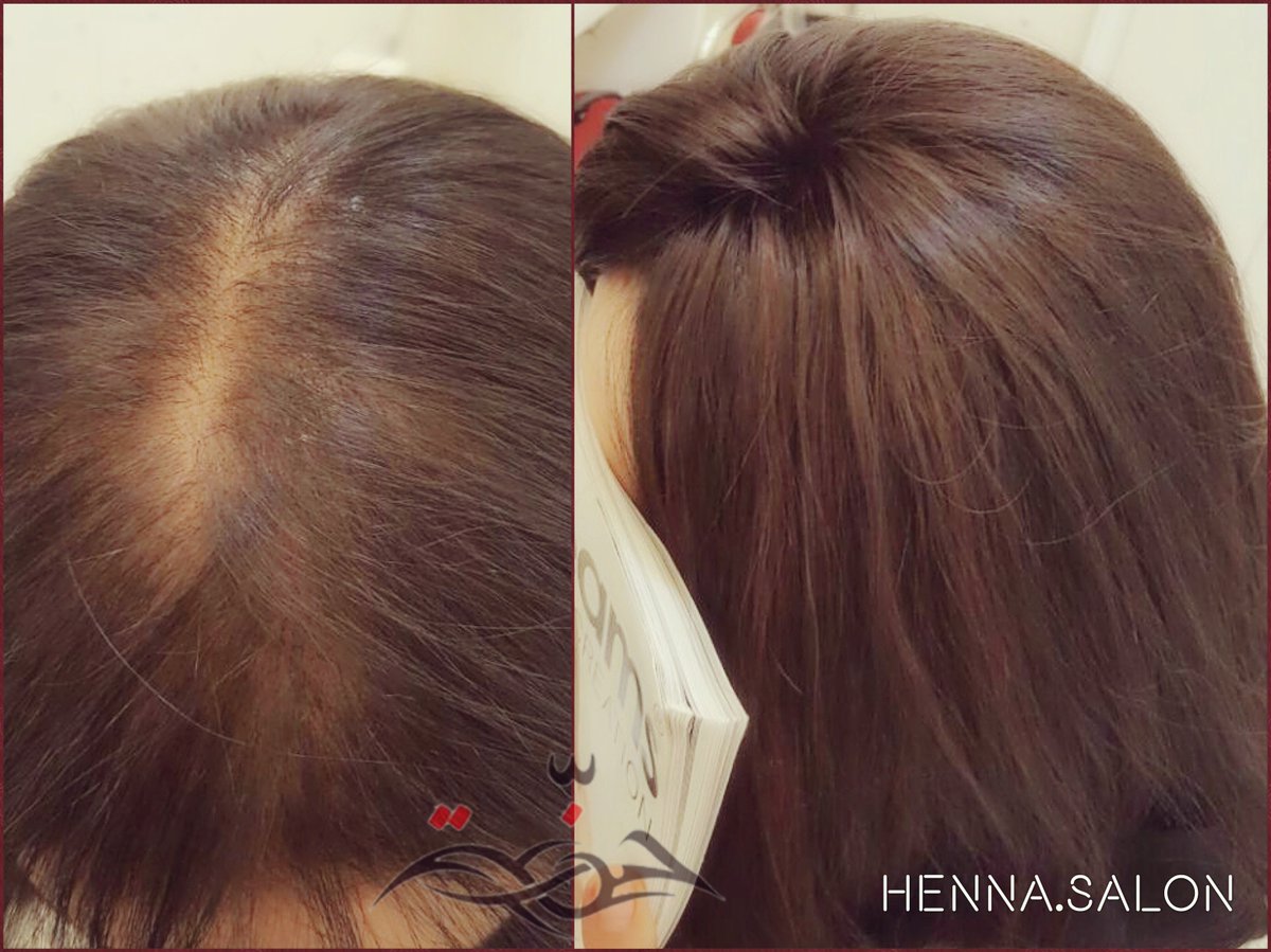 SalonHenna's tweet photo. شعرك خفيف؟! جربي تقنية #المايكرولاين لتعبئة فراغات الشعر
#Microlines method to replenish natural volume on top of the head
#حنة #Henna https://t.co/PzQ9bTimbI