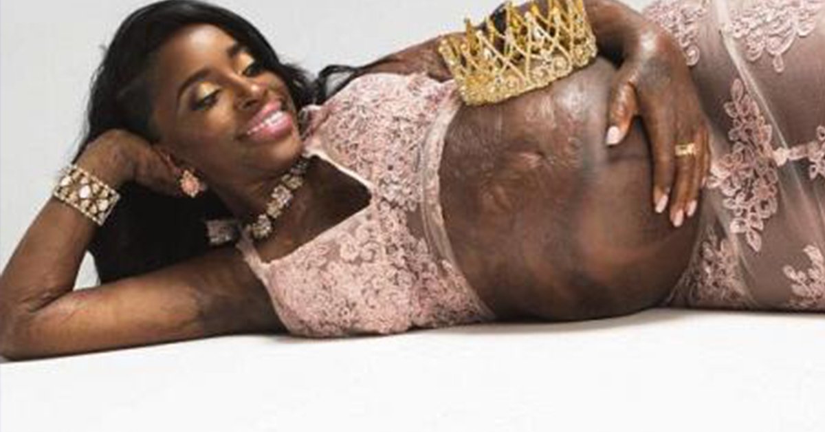 Path_2_Wellness tweet media