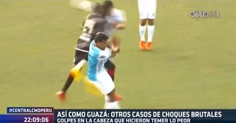MovistarDeporPe's tweet photo. #Informe: Así como Guazá: Otros casos de choques brutales.
😣😱⚽️➡️ https://t.co/S3RmAdqXkD https://t.co/qH7BzgEZOI