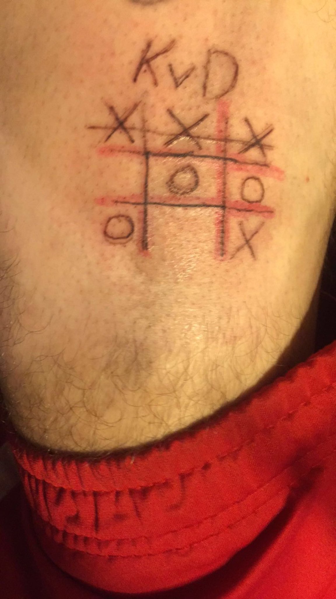 Woman lets friends play noughts and crosses on her leg  using a tattoo gun   Daily Star