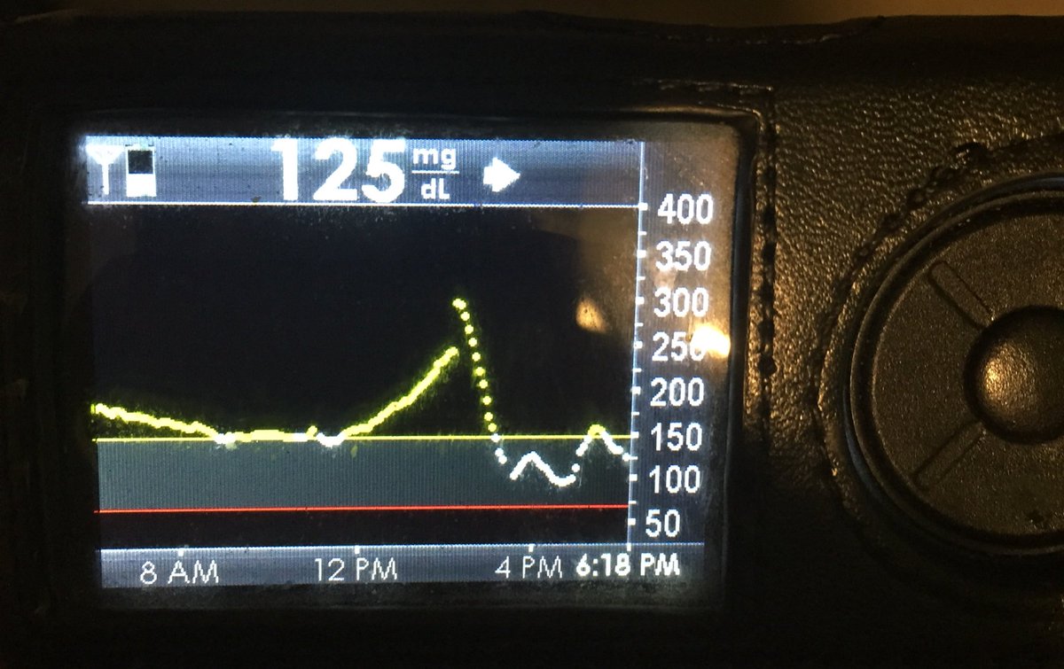 AdamLasher's tweet photo. #Afrezza is the fastest acting insulin in existence. no shots or pump required. #type1 #diabetic #dumpyourpump #seriously #inhaled https://t.co/BLXO2PxEZC