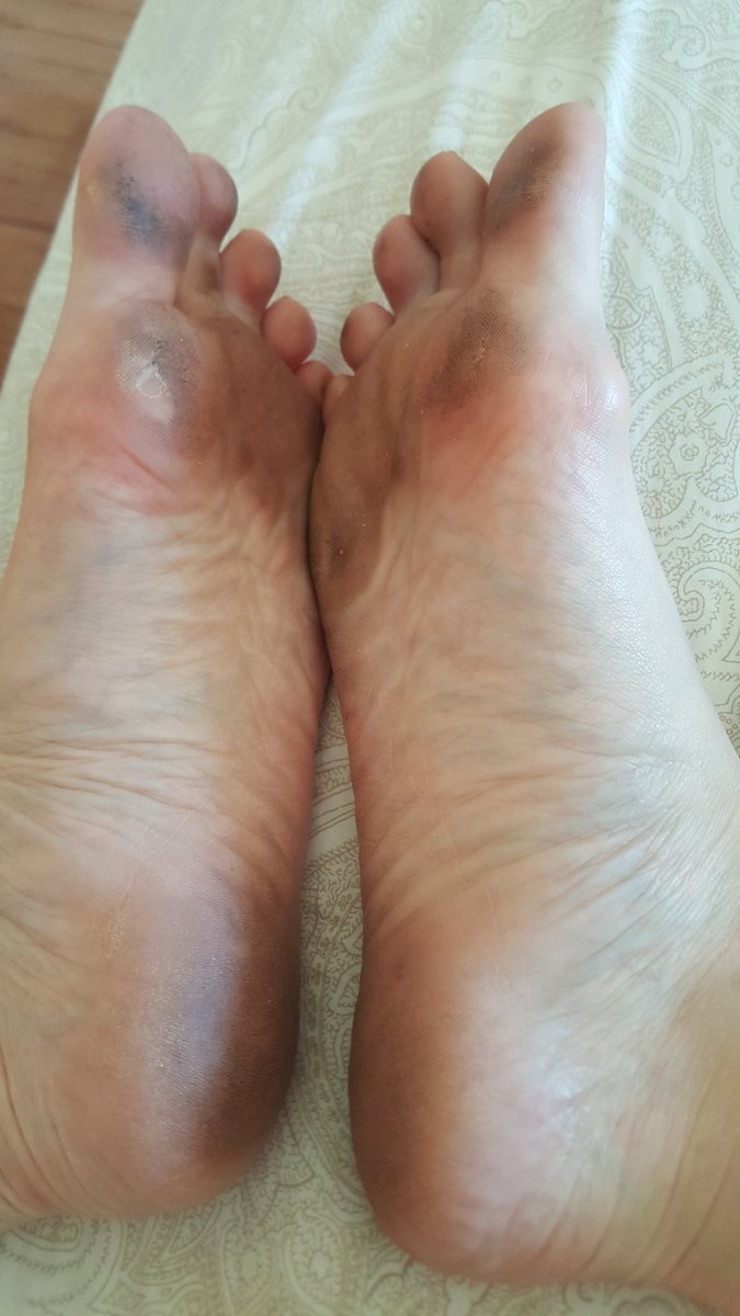 PervertWrangler's tweet photo. Where my #dirtysole lovers at? Walking around with #barefeet takes a toll on them and gets my #feet all #grimy. https://t.co/GnWuirXsAp