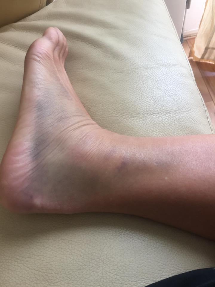 JulieSpringstee's tweet image. Ironman Chattanooga Part 1 jespringsteen.wordpress.com/2016/10/02/iro…