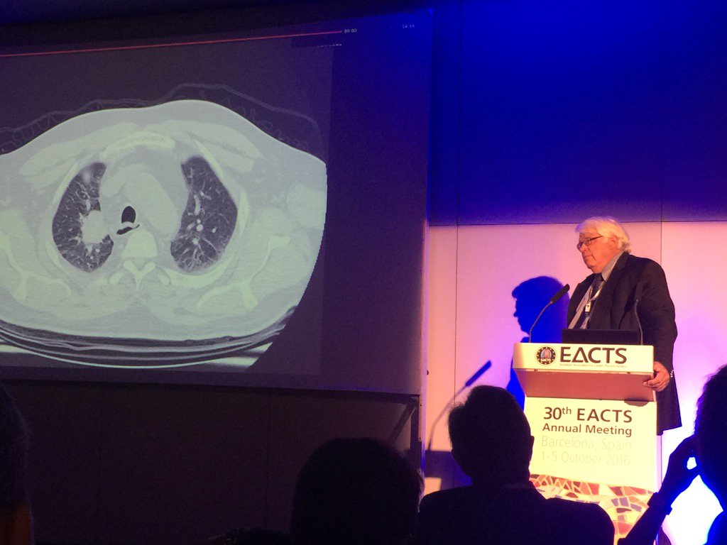 ShandaBlackmon's tweet photo. Doug Mathisen presenting at #ESTS2016 thoracic tumor board. https://t.co/ax5sMzXxFs