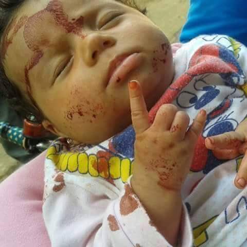 hot609line's tweet photo. من ضحايا الإرهاب الروسي والنصيري في سوريا الجريحة ...
اللهم الطف بهم وعجل فرجهم واكبت عدوك وعدوهم يا قوي ، يا عزيز https://t.co/IGXAH1tOSs