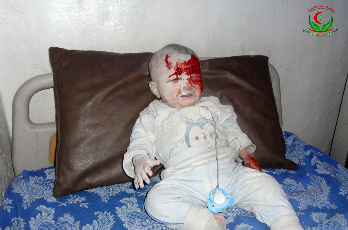 snhr's tweet photo. Image of wounded child in gov warplanes missiles fired on Erbein in #DamascusSuburbs, Oct 2
#Syria https://t.co/kVPmQ80KaK