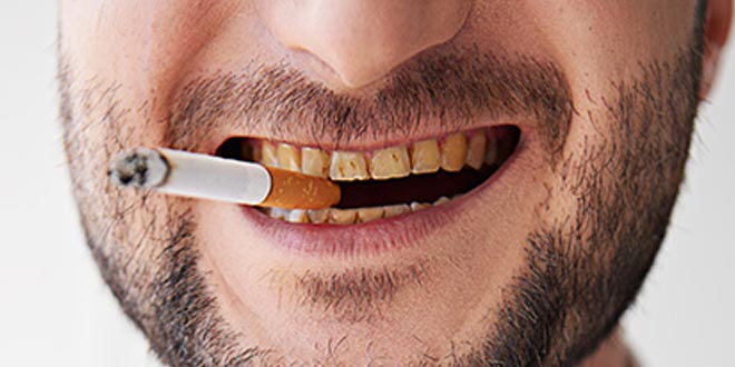 Olaat_Store's tweet photo. #Sabiasque el consumo de #tabaco daña tus #encías y #dientes, tips para dejar de fumar en https://t.co/lga1sYvZOp https://t.co/Yup7TaDqLE