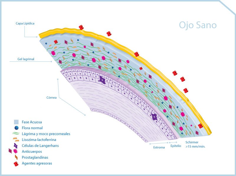 Lab_Santgar's tweet photo. Síndrome del "Ojo Seco" https://t.co/5mjeWBCBrW https://t.co/bqeOKdMZAH