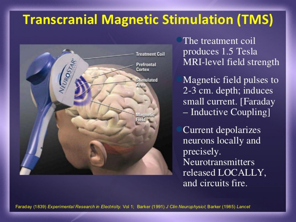 AscensionTMS's tweet photo. If considering #TMS for mental health issues, go with a reputable source for your information, like us! https://t.co/31yRSBjqSW