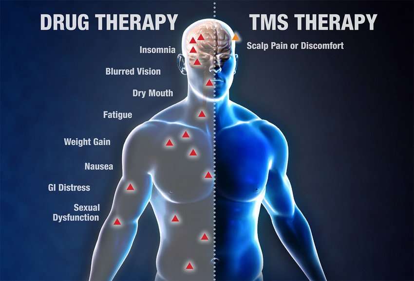 AscensionTMS's tweet photo. #TMS Therapy can treat #depression and mood disorders with limited to no side effects. Contact us to learn more. https://t.co/i1YKKZjtFU