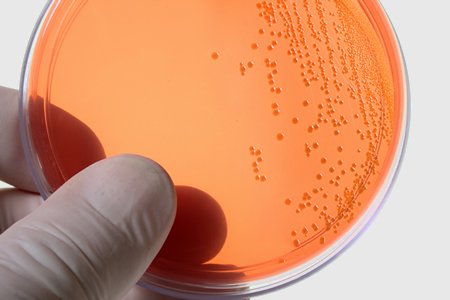 The_Microbiome's tweet photo. A secreted bacterial peptidoglycan hydrolase enhances tolerance to enteric pathogens @sciencemagazine #microbiome https://t.co/clNSrzhQ0S https://t.co/sRt5gAkONx