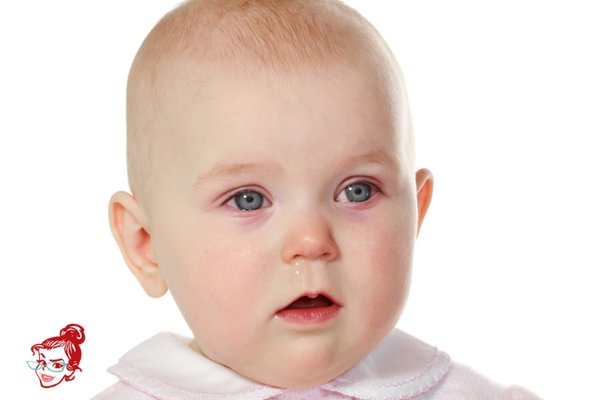 Bebeklerin Gözündeki Kızarıklık Nasıl Oluşur? Tedavisi Nedir? annetavsiyesi.com/bebeklerin-goz…
 #Bebek #kızarıklık #Annetavsiyesi #bebekbakımı